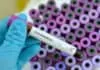 Everything you need to know about COVID-19 coronavirus acquirehowto