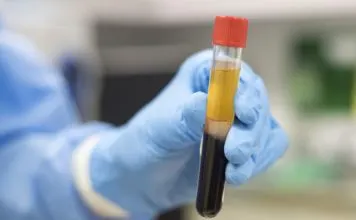 Convalescent Plasma Therapy: A Miracle Cure for coronavirus Plasma Therapy